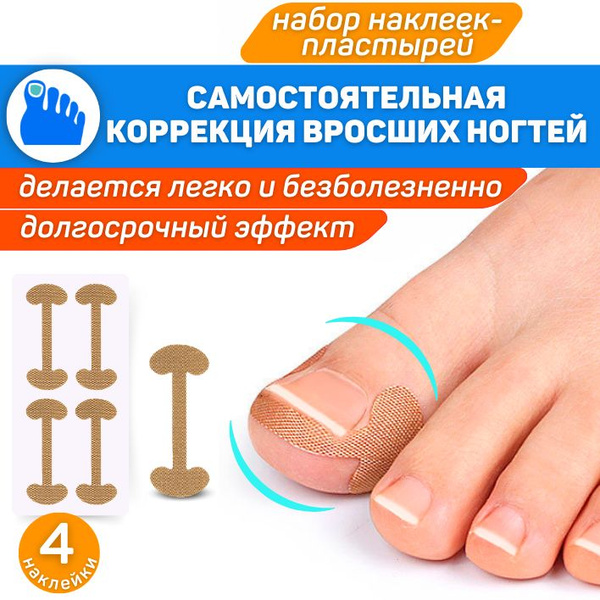 ORTGUT Набор наклеек для коррекции вросших ногтей / Пластырь для ...