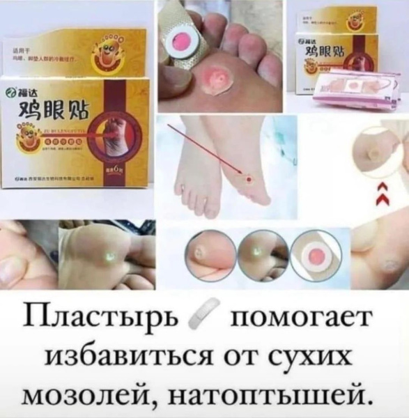 Пластырь от натоптышей и сухих мозолей Shuiyangsuan Benfen Tiegao ...