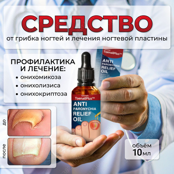 Cредство от грибка ногтей на ногах и руках. Лак-мазь для лечения ...