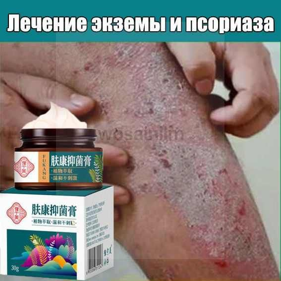 Мазь от псориаза / Крем антибактериальный для кожи / 30g При псориазе ...