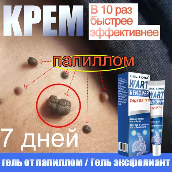 Средство от папиллом и бородавок, мазь для ухода за кожей, крем от ...