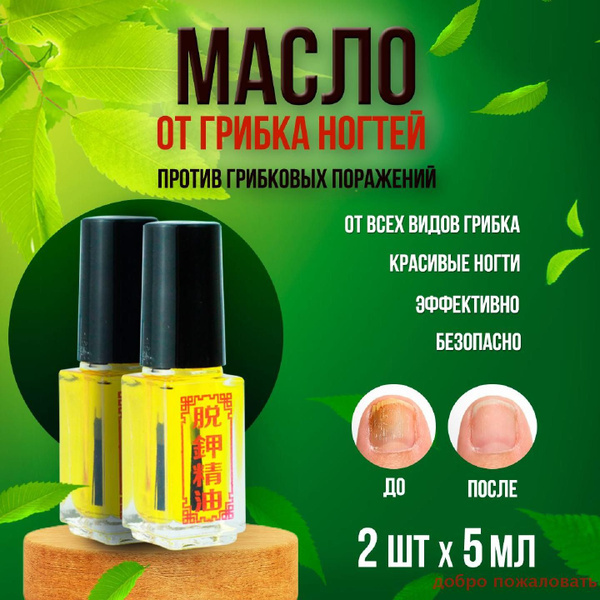 Масло для ногтей, средство от грибка ногтей на ногах, SilaVeres, 2х5мл ...
