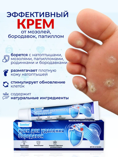 Средство от мозолей и натоптышей на ногах / Мазь от бородавок и ...