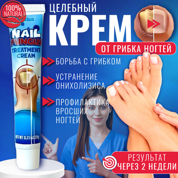 Крем от грибка ногтей / Мазь уход за ногтями и кожей ног / Чудо ...