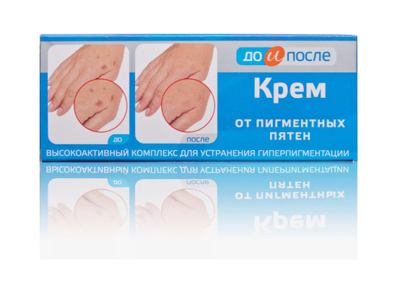 Крем от пигментных пятен ДО и ПОСЛЕ, 50мл - купить с доставкой по ...