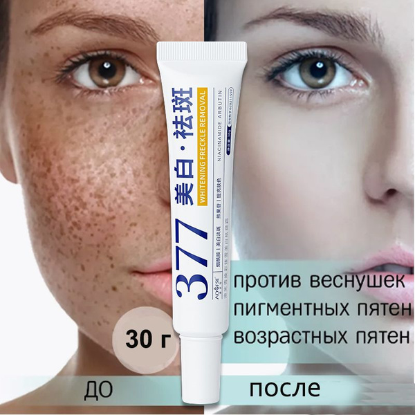 Крем для отбеливания и удаления веснушеk,30g, для удаления веснушек ...