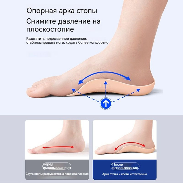 Супинаторы ортопедические / Гелевые полустельки от плоскостопия ...