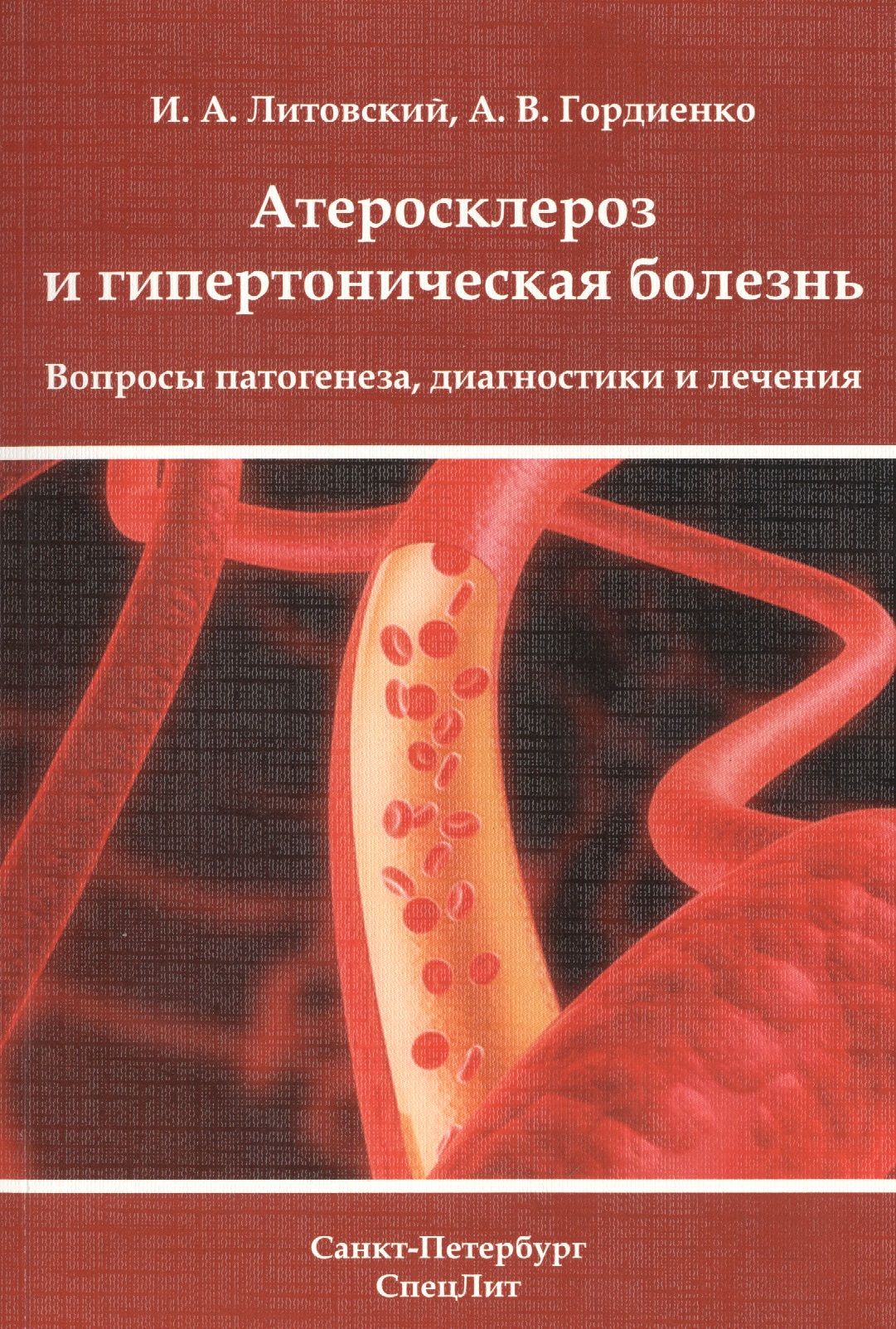 Атеросклероз наследственность. Гипертоническая болезнь и атеросклероз. Атеросклероз и гипертония. Атеросклероз и артериосклероз. Диагностика гипертонической болезни.