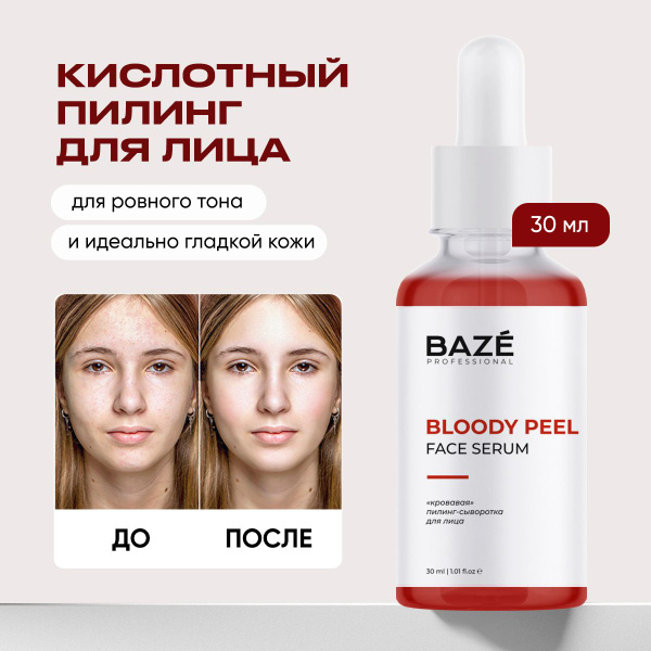 Кровавый кислотный пилинг BAZE для лица 30 мл купить на OZON по низкой ...