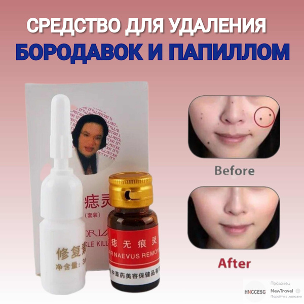 Бальзам для удаления папиллом, родинок и бородавок, средство от ...