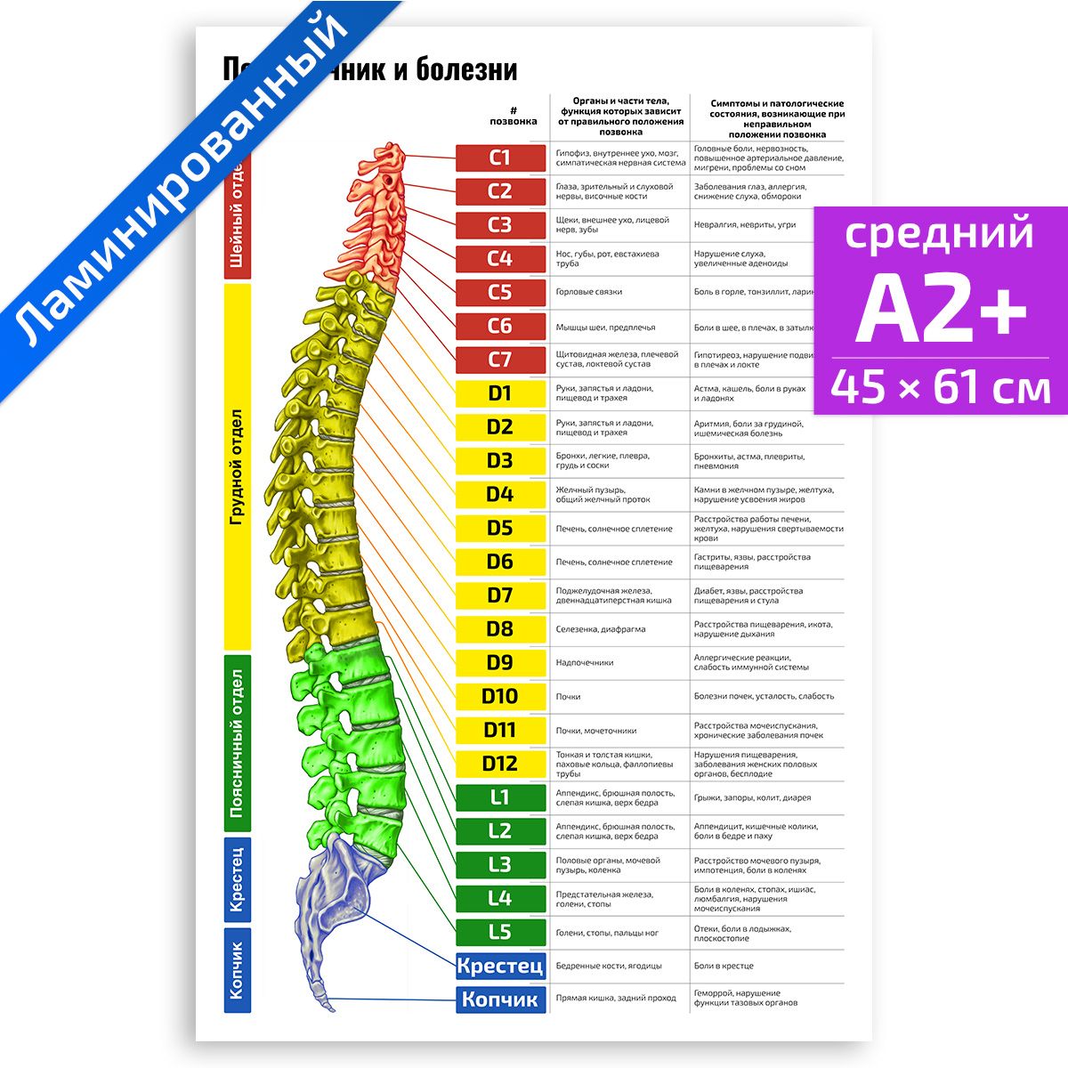 Плакат обучающий А2 ламинир. Позвоночник и болезни медицинский 457x610 мм