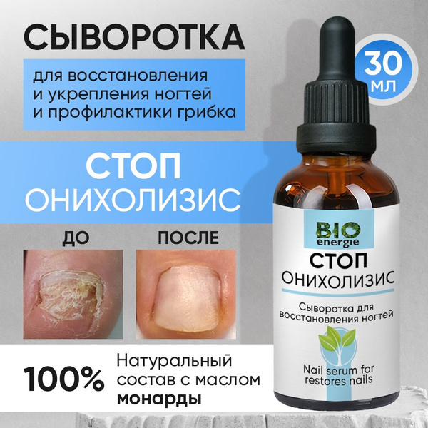 Сыворотка для ногтей, от онихолизиса ногтей, от грибка, для кутикулы ...