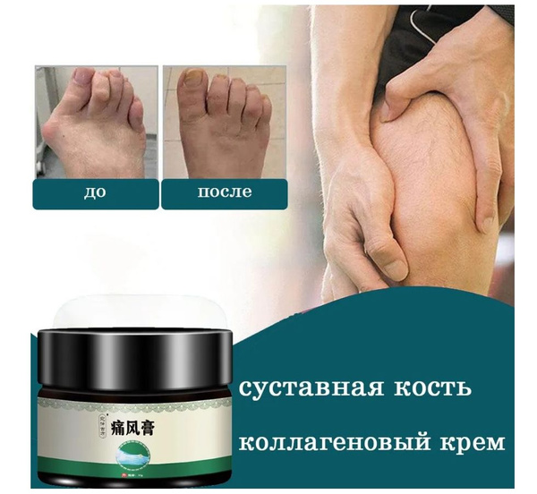 Мазь от подагры, для ног и коленного сустава, крем от боли в суставах ...