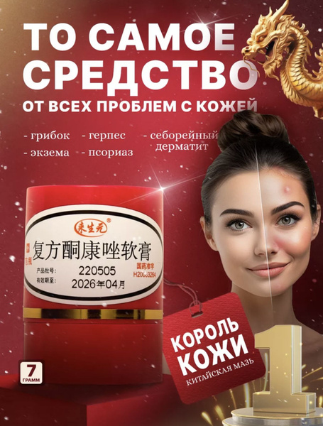 Мазь от псориаза "Король кожи".1шт. купить на OZON по низкой цене ...