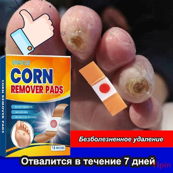 пластырь от сухих мозолей и натоптышей,10 наклеек,Пластырь от сухих ...