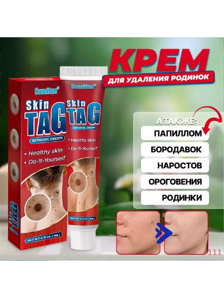 Крем средство от папиллом и бородавок - купить с доставкой по выгодным ...