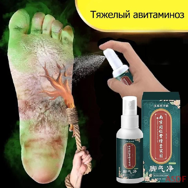 Противогрибковый спрей, от грибка ногтей на ногах, от трещин, для пяток ...