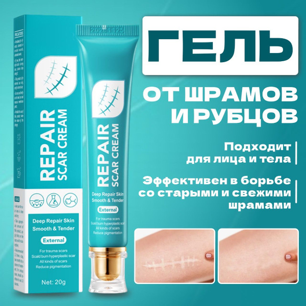 Заживляющий гель от шрамов и ожогов, крем от рубцов и растяжек ...
