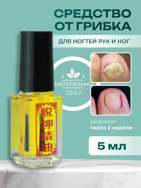 Средство от грибка ногтей на ногах и руках, масло от грибка ногтей на ...