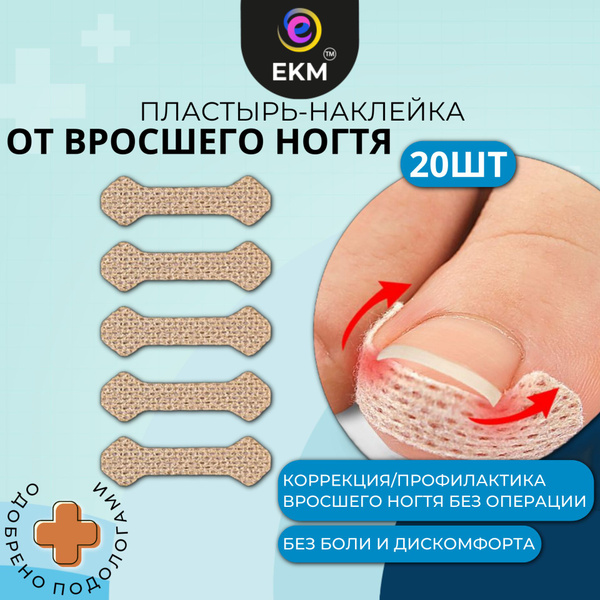 От вросшего ногтя пластырь - корректор наклейки ЕКМ, при врастании ...