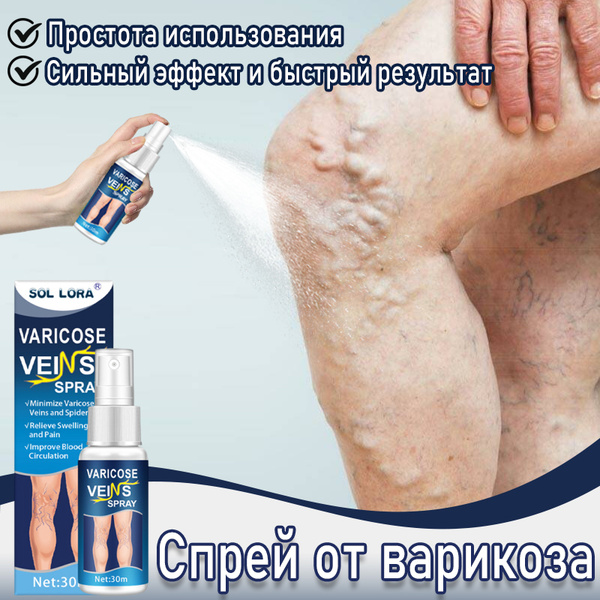 SOL LORA Спрей от варикоза, 30мл , эффективен при сосудистых звездочках ...