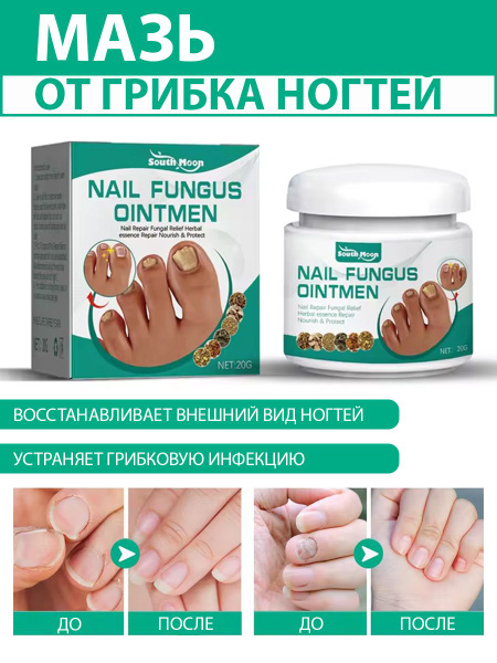 Мазь от грибка ногтей на руках и ногах, противогрибковое средство для ...