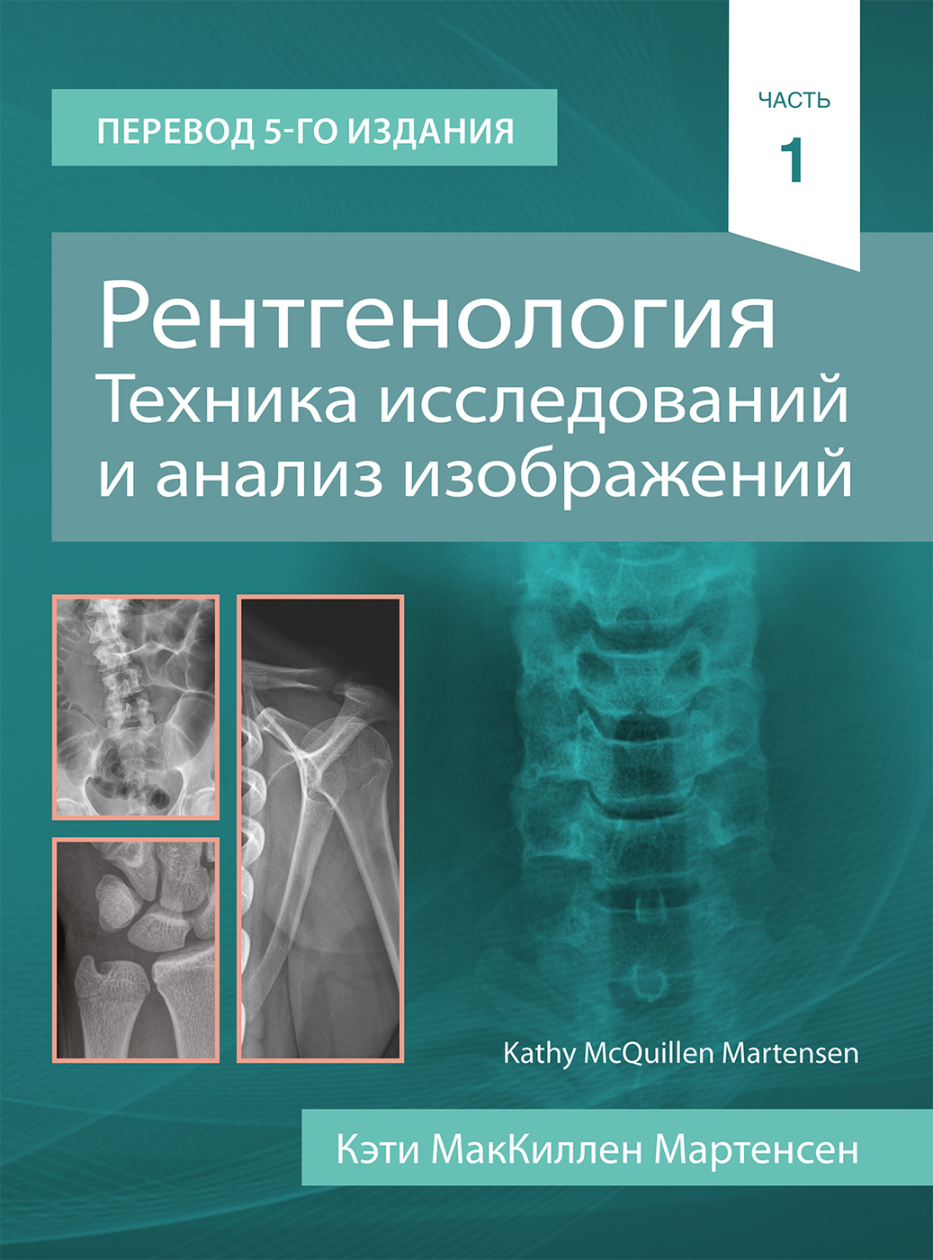 Рентгенология. Техника исследований и анализ изображений (комплект в 2-х  томах) - купить с доставкой по выгодным ценам в интернет-магазине OZON  (239590197)