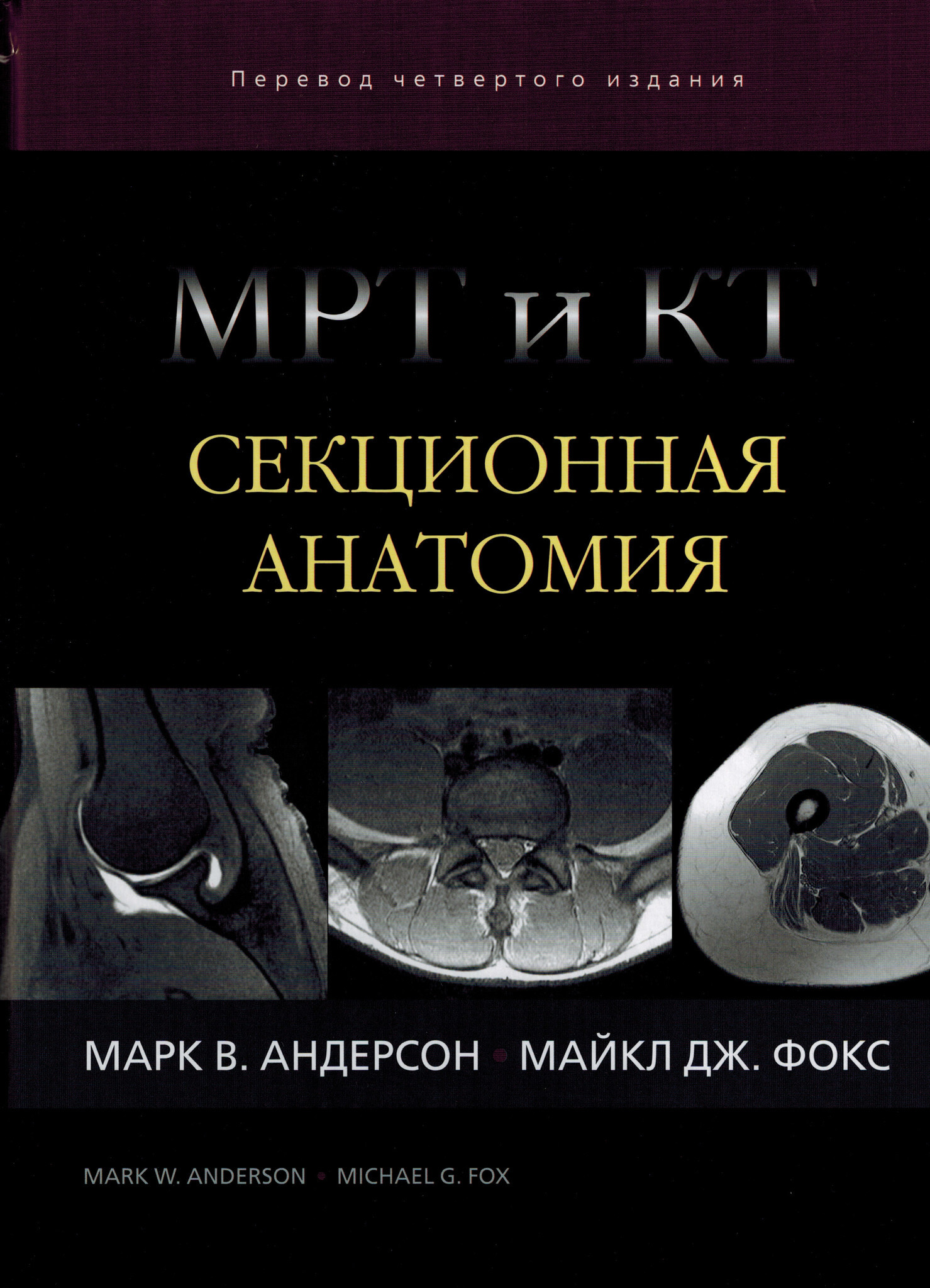 Секционная анатомия кт. Секционная анатомия кт и мрт. Атлас по кт анатомии. Секционная анатомия Андерсен. Книги по мрт.