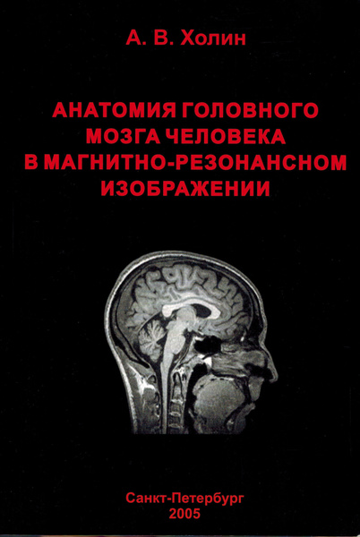 Анатомия головного мозга человека в магнитно-резонансном изображении ...