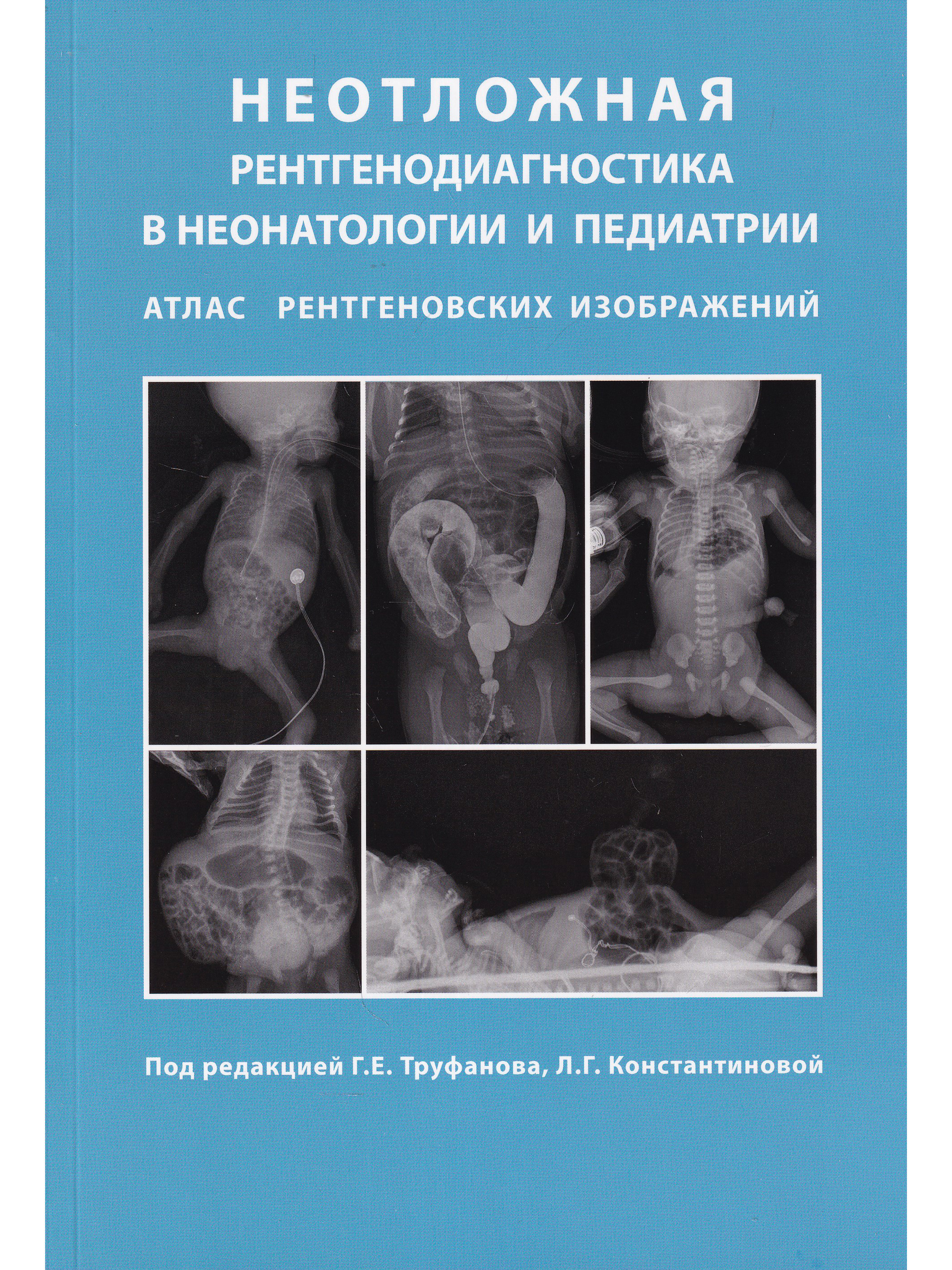 Неотложная рентгенодиагностика в неонатологии и педиатрии атлас рентгеновских изображений