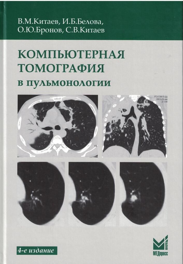 Компьютерная томография в пульмонологии