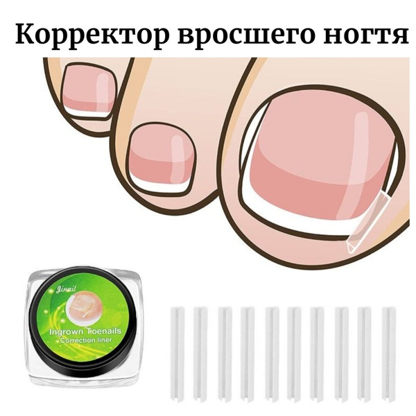 Подушечки для коррекции вросших ногтей 10 шт./вросший ноготь/лечение ...