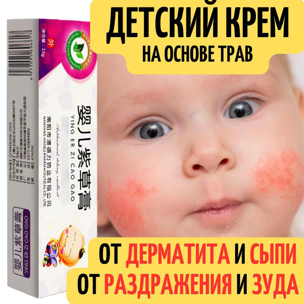Детский крем от раздражений, атопического дерматита, сыпи и зуда ...