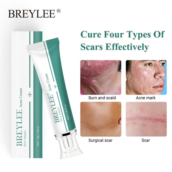BREYLEE Крем для удаления шрамов, угревой сыпи и устранения рубцов ...
