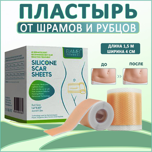 Лейкопластырь силиконовый от шрамов и рубцов 4х150 бежевый - купить с ...