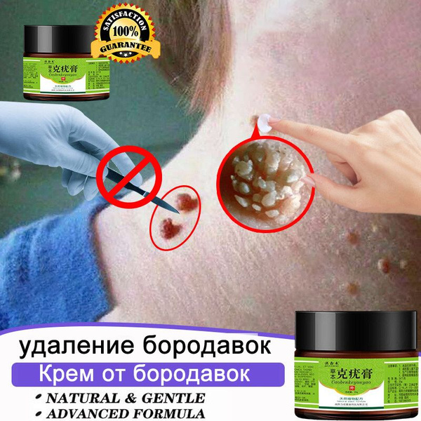 Средство для удаления бородавок, Крем от бородавок 20г ...
