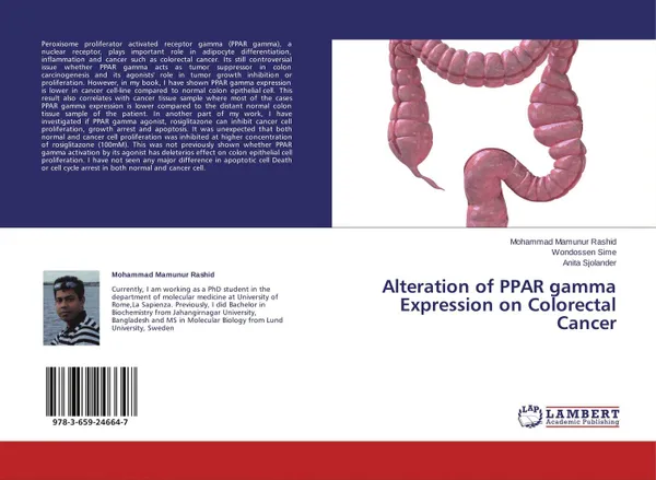 Обложка книги Alteration of PPAR gamma Expression on Colorectal Cancer, Mohammad Mamunur Rashid,Wondossen Sime and Anita Sjolander