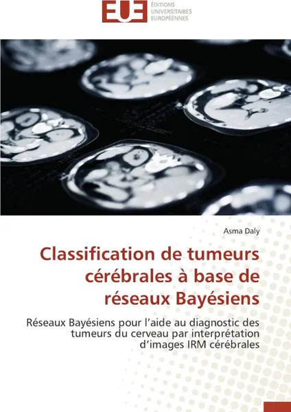 Обложка книги Classification de tumeurs cerebrales a base de reseaux bayesiens, DALY-A