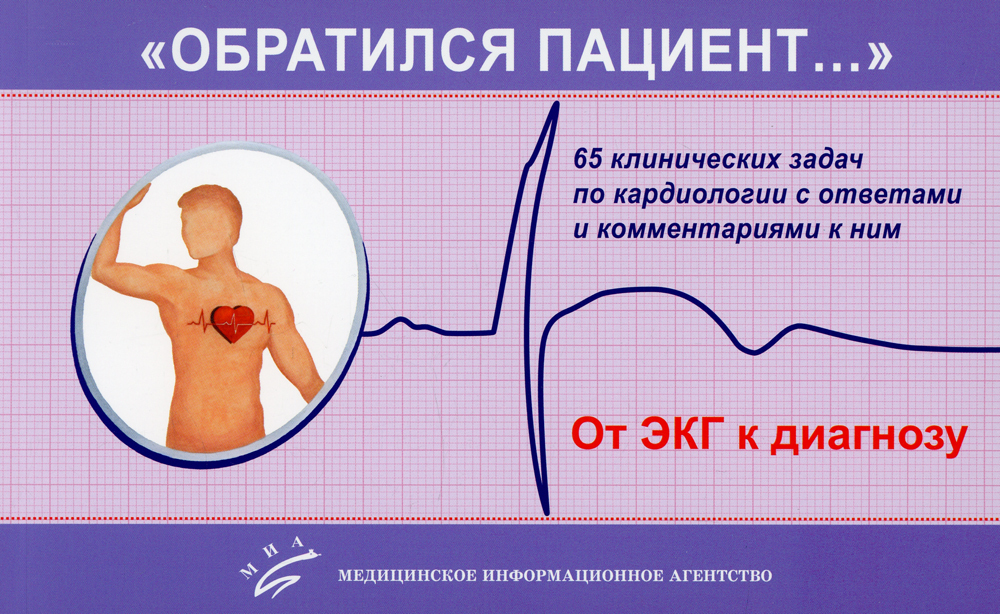 Дсу в кардиологии
