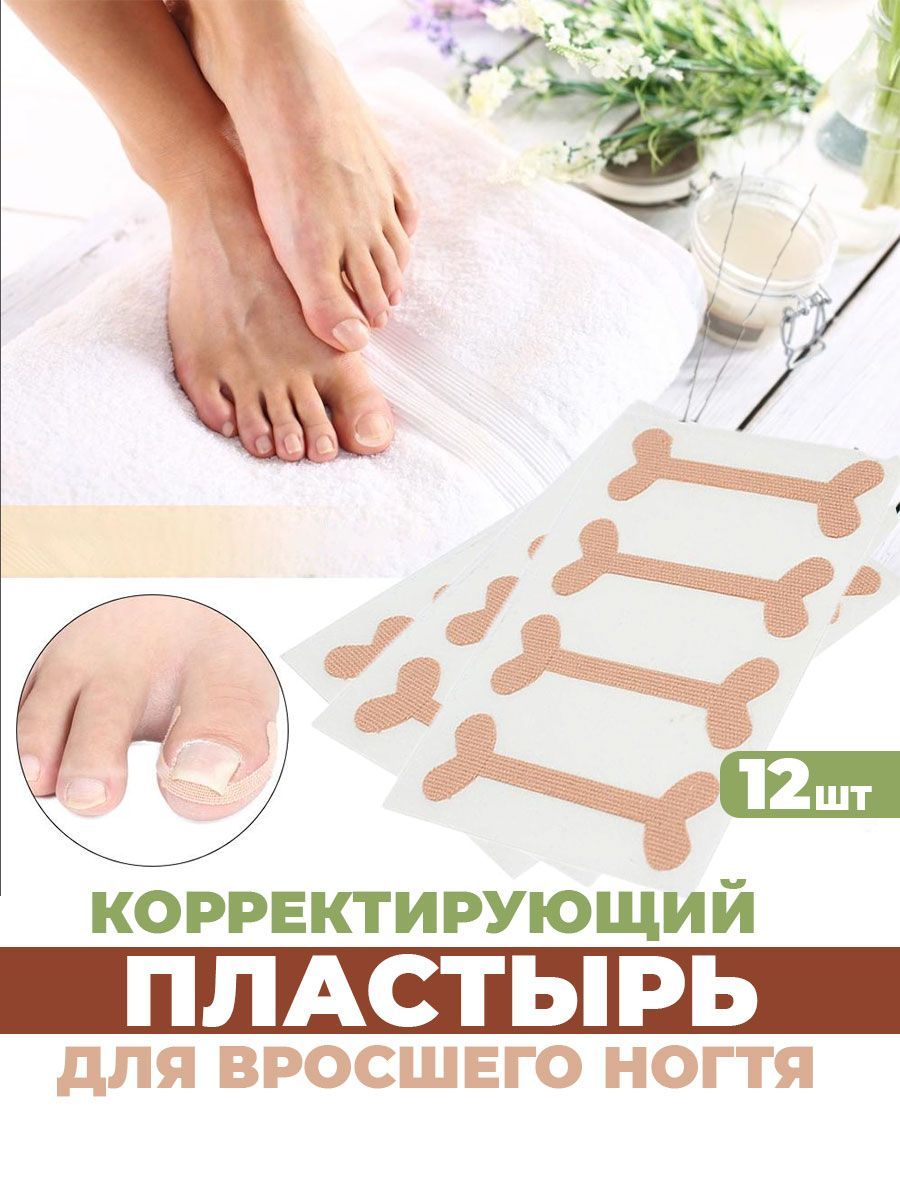 Корректор от вросшего ногтя Wellness Ultracare plfixnail - купить по  выгодной цене в интернет-магазине OZON (1175414237)