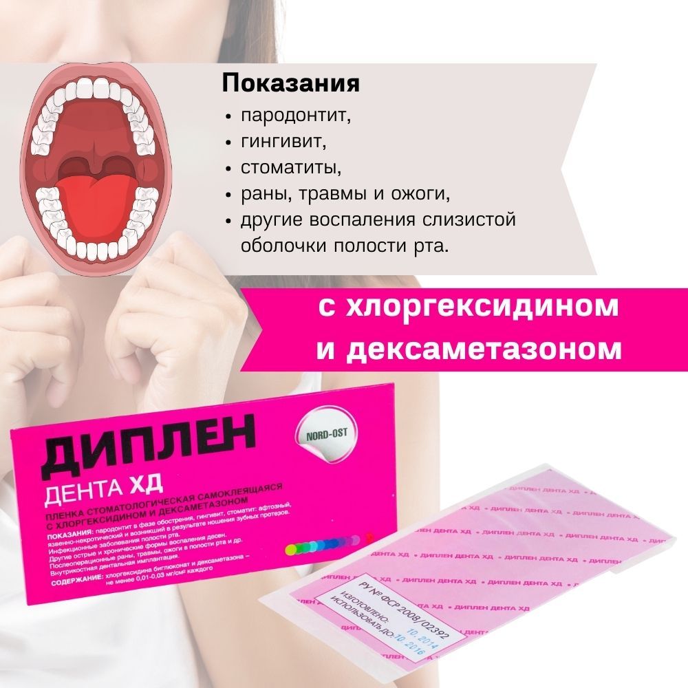 Диплен Дента Г Купить В Аптеке Сургут