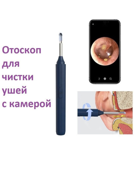 Умный портативный отоскоп со встроенной камерой. синий. - купить с ...