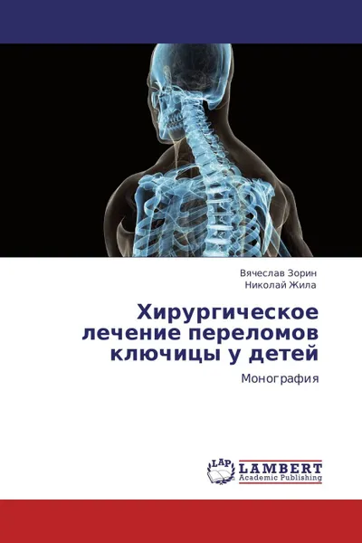 Обложка книги Хирургическое лечение переломов ключицы у детей, Вячеслав Зорин, Николай Жила