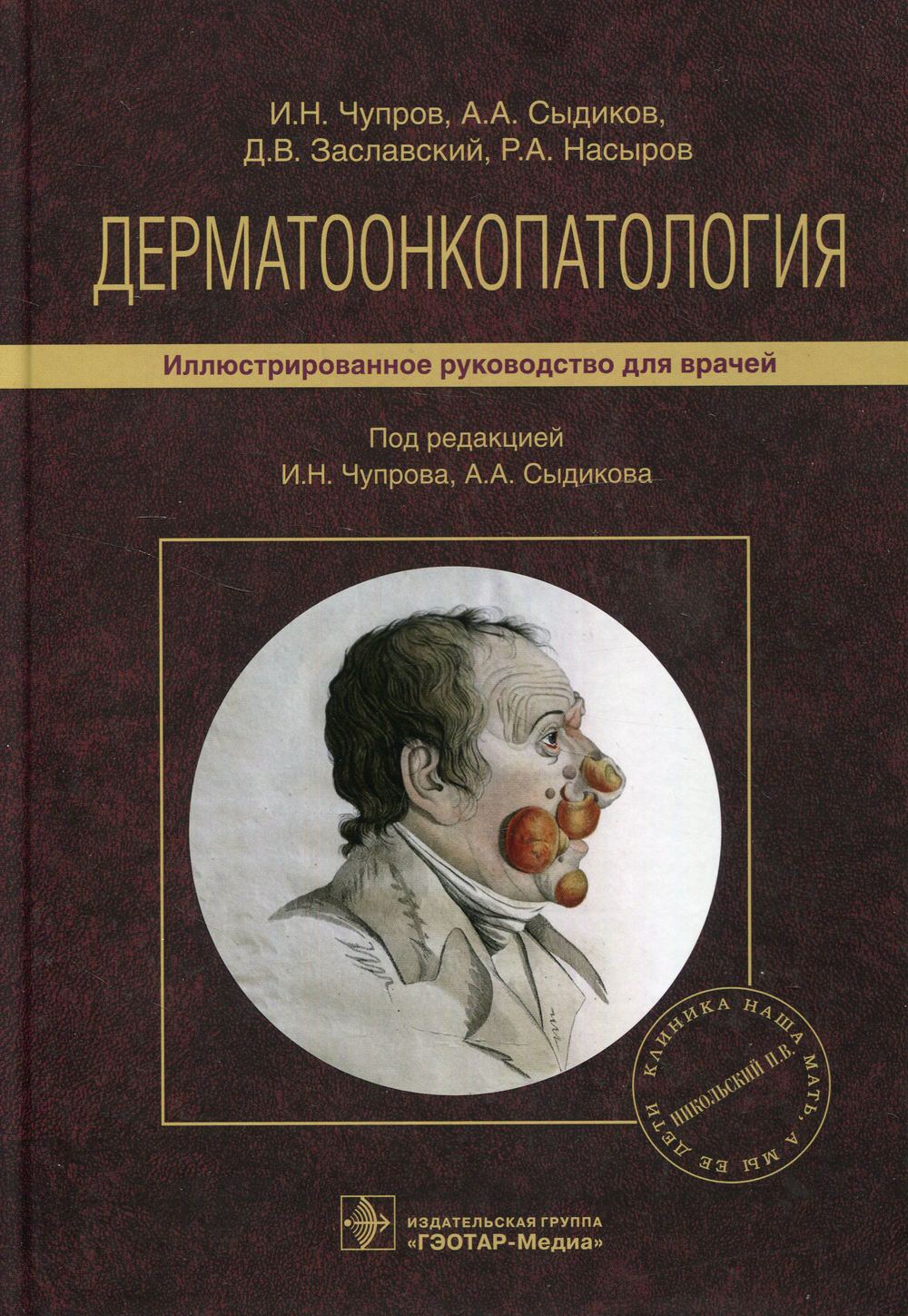 Дерматоонкопатология: иллюстрированное руководство для врачей | Заславский  Денис Владимирович, Чупров Игорь Николаевич - купить с доставкой по  выгодным ценам в интернет-магазине OZON (327415566)