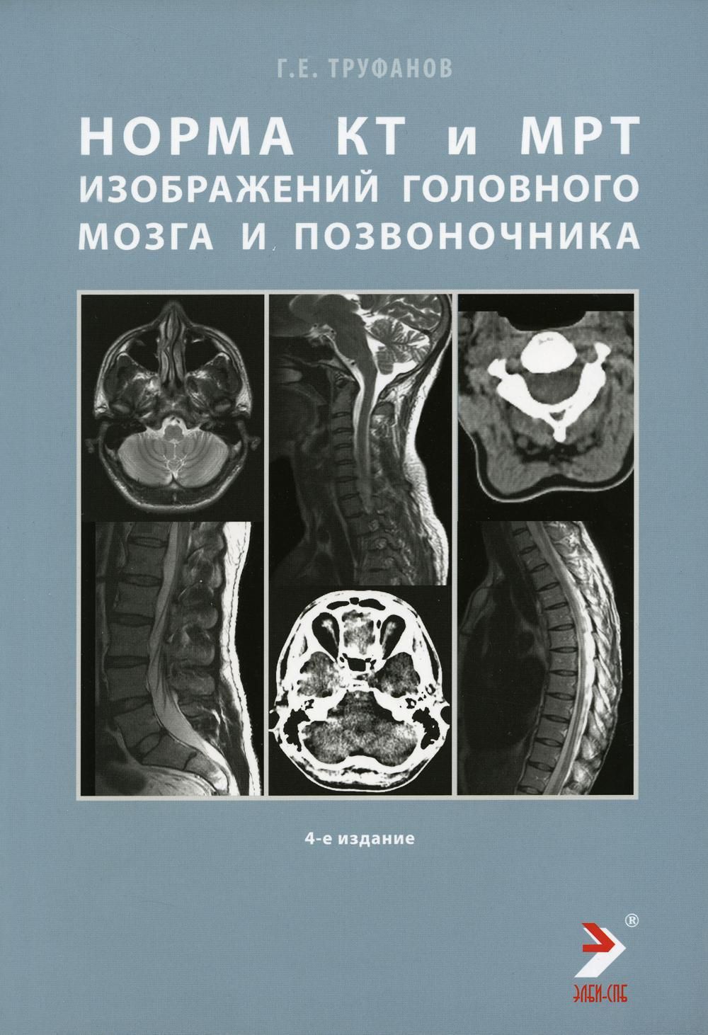 Норма КТ- и МРТ- изображений головного мозга и позвоночника: атлас  изображений. 4-е изд | Труфанов Геннадий Евгеньевич