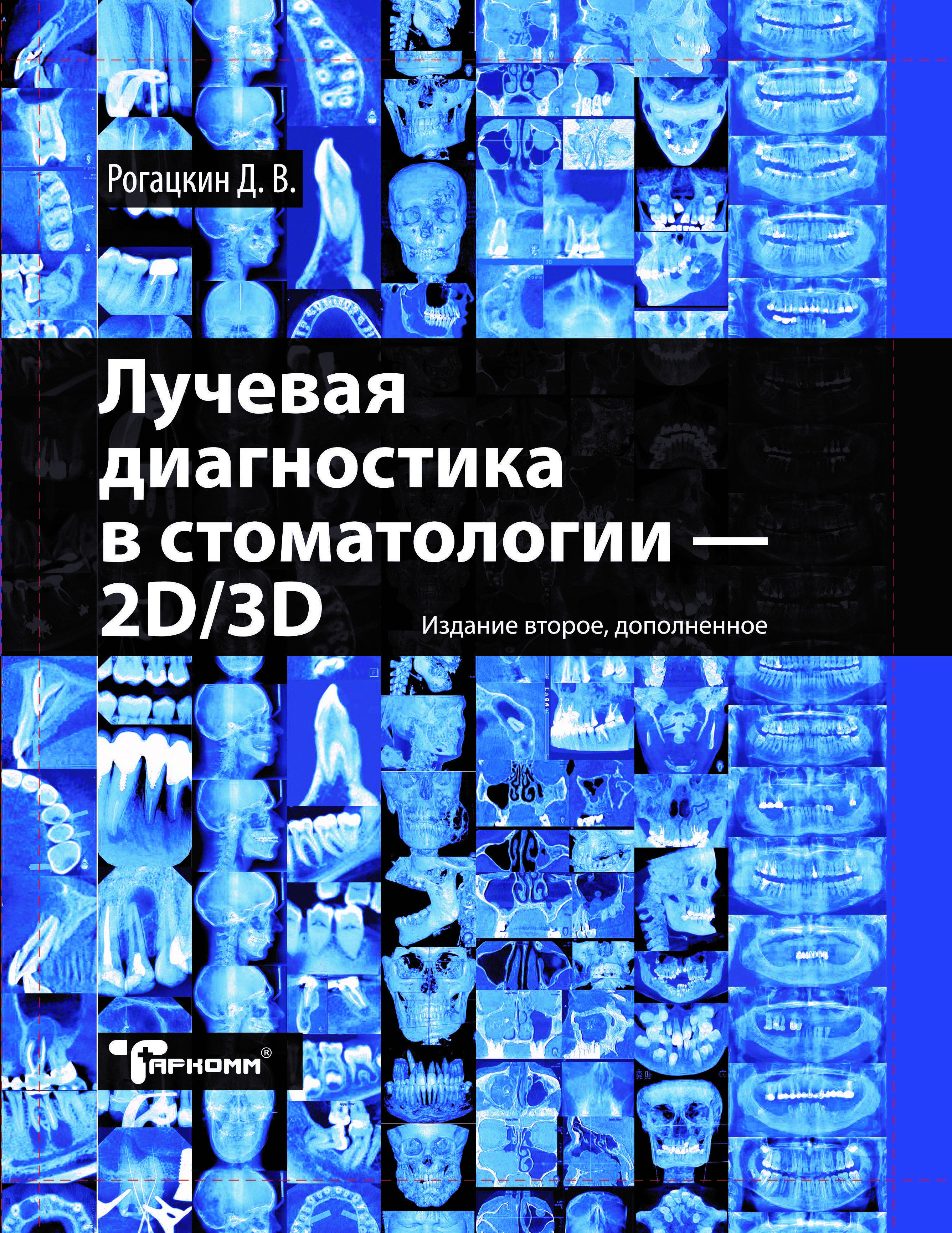 Лучевая диагностика в стоматологии. Лучевая диагностика 2д 3д Рогацкин. Лучевая диагностика книга. Рентгенодиагностика в стоматологии книги. Рогацкин - лучевая диагностика в стоматологии - 2d/3d.