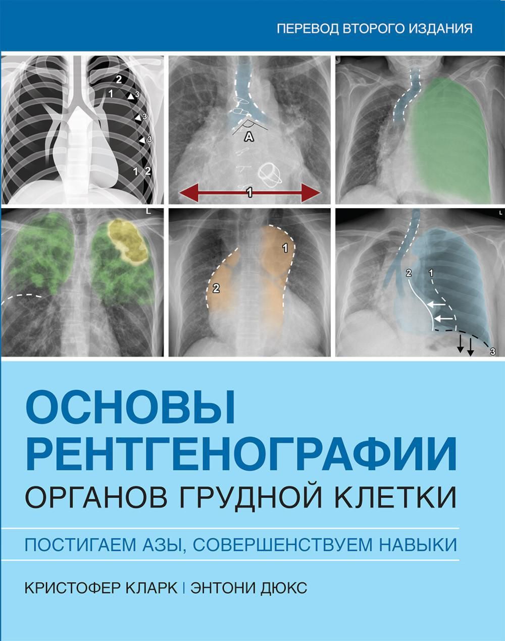 Основы рентгенографии органов грудной клетки - купить с доставкой по  выгодным ценам в интернет-магазине OZON (1315631669)