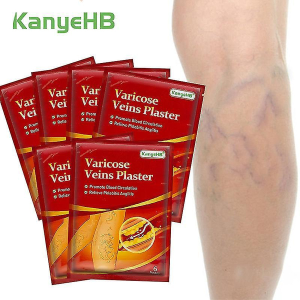 Kanyebh Varicose Veins Plaster Пластырь обезболивающий от варикоза,1 ...