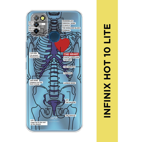 Силиконовый чехол на Infinix HOT 10 Lite / Инфиникс Хот 10 Лайт "Скелет ...