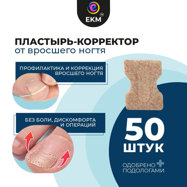 От вросшего ногтя пластырь - корректор ЕКМ, при врастании ногтевой ...